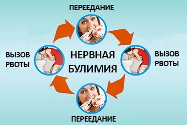 Лечение булимии в Сылве